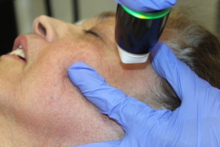 Regenerative treatment at Zenskinsation
