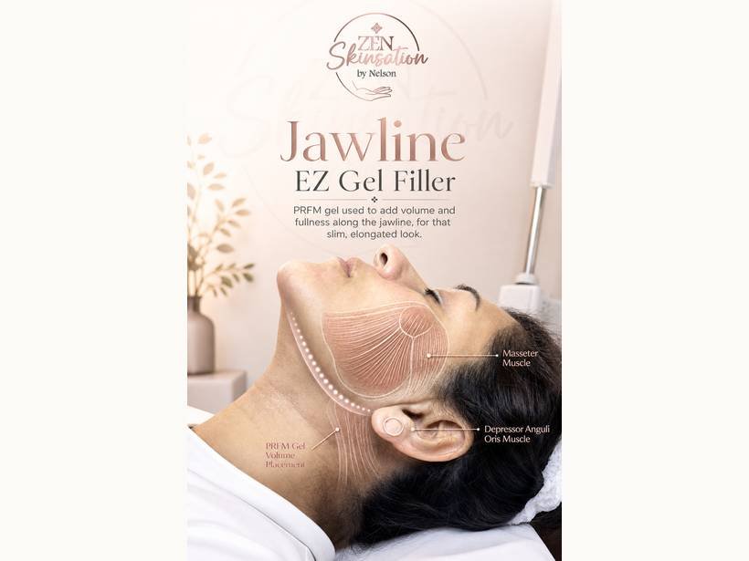 Jawline EZ Gel Filler anatomy at Zenskinsation