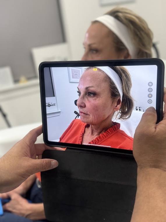 Skin assessment at Zenskinsation