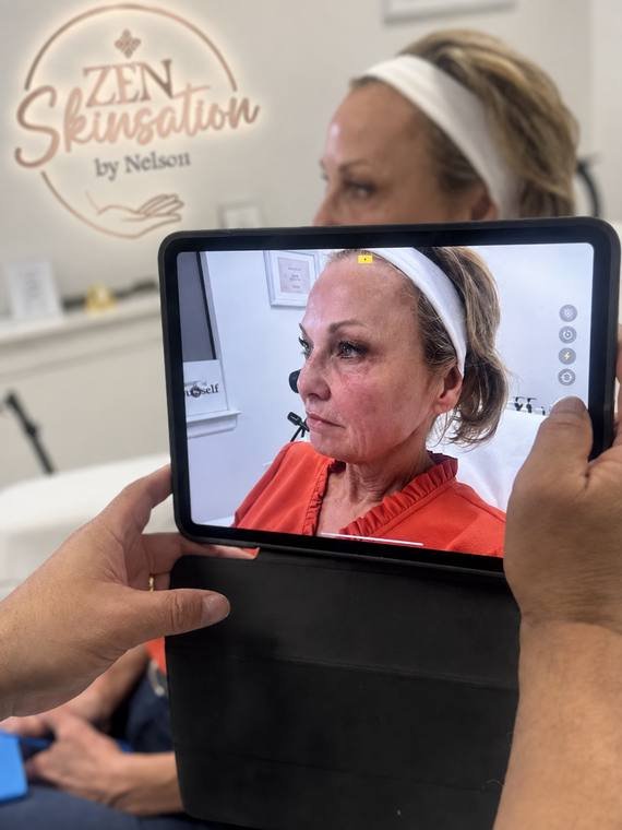 Before and after review at Zenskinsation