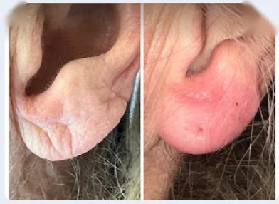 Before and after result — Zenskinsation